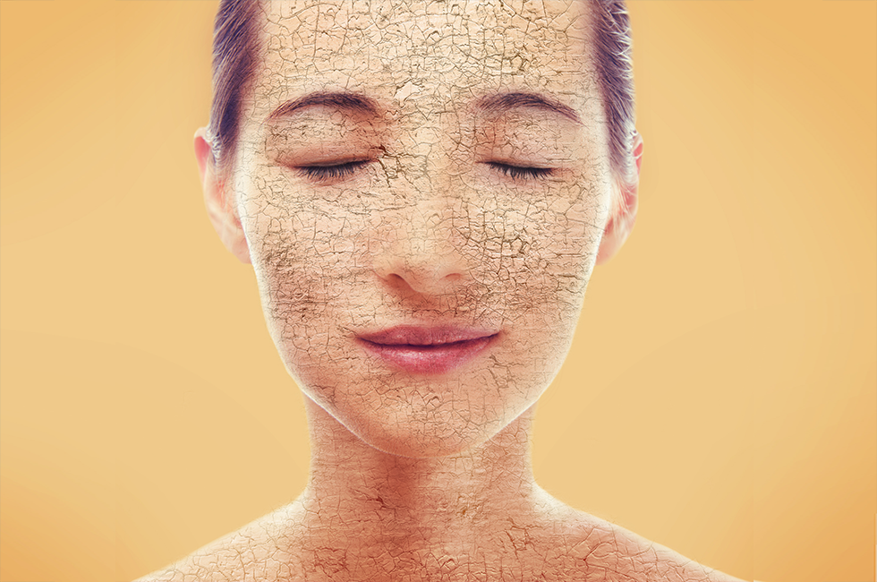 Guideline Untuk Menghindari Komplikasi Kulit Bagi Pasien Chemoteraphy